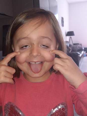 grimace